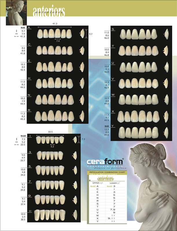 Ceraform mold chart.