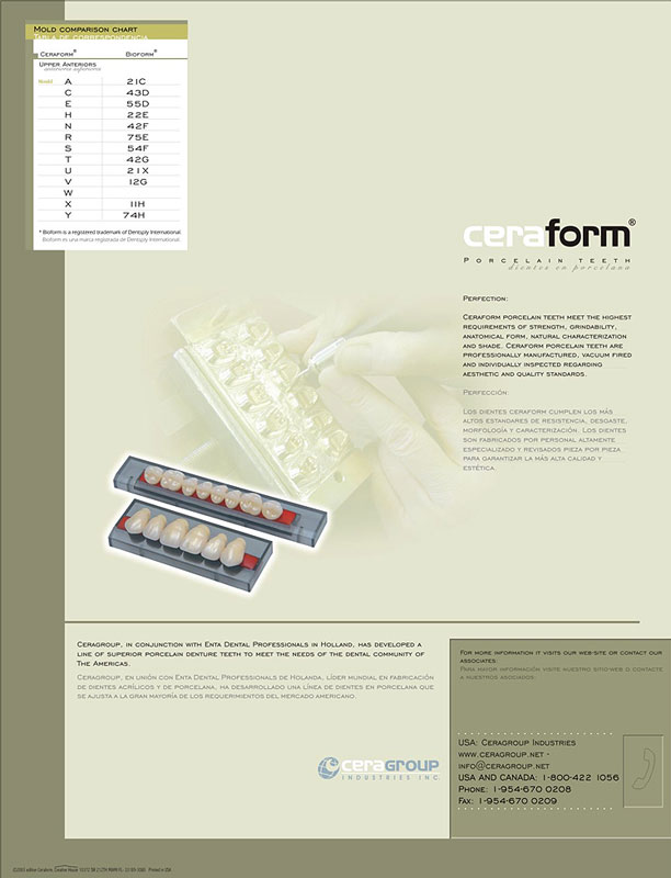 Ceraform mold chart.